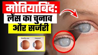 मोतियाबिंद लेंस का चुनाव और सर्जरी  Cataract Risk Factors मोतियाबिंद सरल उपचार  Cataract Surgery [upl. by Bej]