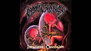 Malignancy  Intestinal Sodomy [upl. by Umberto]