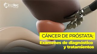 Cáncer de próstata Exámenes de diagnóstico y tratamientos [upl. by Ramoh]