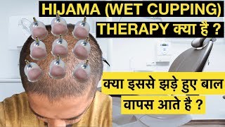 Hijama Cupping Therapy for Hair Regrowth  क्या इससे झड़े हुए बाल वापस आते है  Genuine Tips [upl. by Foote]