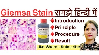 Giemsa stain in Hindi  principle  procedure  result  MLT  histopathology  Haematology [upl. by Llerod]