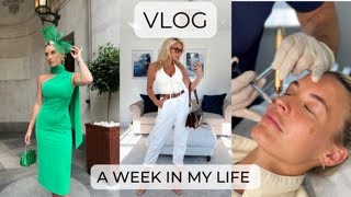 VLOG A Week in my Life x PHOTOSHOOTS  FILLER INJECTIONS  WEEKEND PARK RUN  DIY PANELLING amp MORE [upl. by Sheryle]