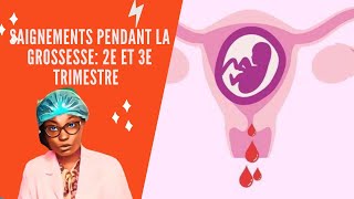 Le saignement pendant la grossesse 2e et 3e trimestre [upl. by Enyaw]