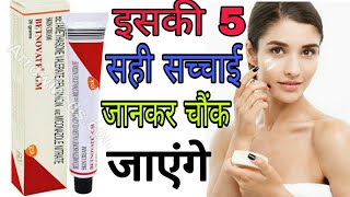 Betnovate GM cream review in Hindi  Betnovate GM cream review Betnovate GM cream [upl. by Scheld]