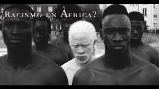 Albinos en África La vida de los ALBINOS en AFRICA es un martirio [upl. by Lexis]