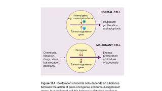 LYMPHOID NEOPLASMS Lecture 5 By Dr Rafiq Cheema Class 4th year [upl. by Enilorak]