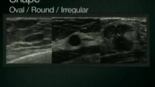 Breast Ultrasound Lesion Assessment BIRADS Ultrasound [upl. by Imtiaz]