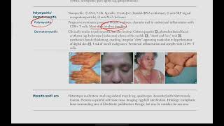 Polymyositis  Dermatomyositis  Musculoskeletal  28  First Aid USMLE in UrduHindi [upl. by Nosnaj884]