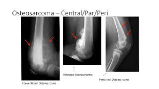 lecture series review Orthopaedic Pathology voice [upl. by Lavona995]