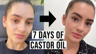 TOP 5 Best Castor Oil Eye Drops 2023 [upl. by Everson12]