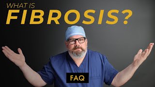 What Can You Do To Prevent FIBROSIS After Liposuction [upl. by Yrkcaz]