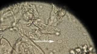 Trichomonas vaginalis on 40x microscope [upl. by Charlet688]