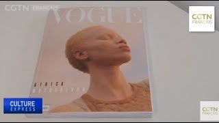 La première femme albinos en couverture du magazine Vogue [upl. by Cal386]