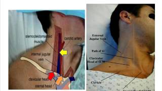 Jugular venous pulse anatomical aspects [upl. by Dorfman513]