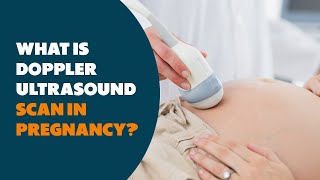 What is Doppler Ultrasound scan in Pregnancy pregancy pregnancyscan doppler ultrasoundscan [upl. by Burgess]