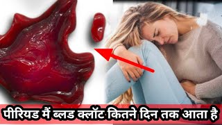 Period Me blood clot kyu aaye hai  period main blood clot kitne din tak aata hai [upl. by Anneehs]