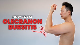 How to do exercises for Olecranon Bursitis  One cause of elbow pain in the triceps region [upl. by Marutani]