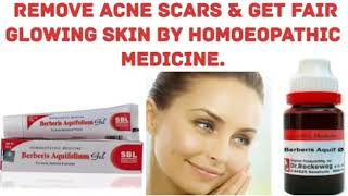 Homoeopathic Medicine For removing deep Acne Scar [upl. by Narod]