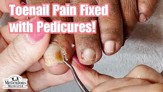 Pedicure Beauty Series No More Painful Toenails [upl. by Aikemehs259]