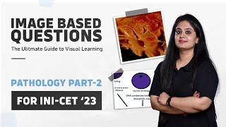 Get Ahead in Pathology for INICET 2023 High Yield IBQ by Dr Preeti Sharma  Part2 [upl. by Mcquillin]