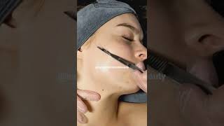 Get Dermaplaning Facial Treatment for baby smooth skinglowup skincare reel shorts viralvideo [upl. by Aramo133]