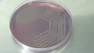 Stenotrophomonas maltophilia colony morphology on CLED agar [upl. by Azeret601]