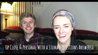 Up Close amp Personal With a Stoma  Questions Answered [upl. by Suneya]