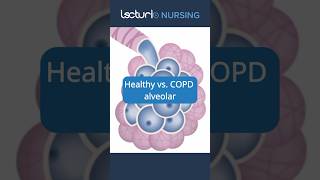 Healthy vs COPD Lungs 🫁 LungHealth COPDAwareness nclexrn [upl. by Alemat786]