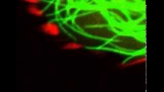 Microtubules poking focal adhesions [upl. by Hanako130]