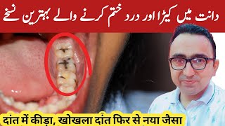 Top 4 Home Remedies For Tooth Cavity  Dental Carries  Dr Javaid [upl. by Zoellick223]