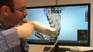 Intra Oral scanning with 3Shape TRIOS [upl. by Randy]