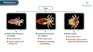 Pediculosis  Dermatology Lectures [upl. by Shirleen]