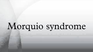 Morquio syndrome [upl. by Eixirt586]