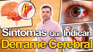 Ojo Con Estos Síntomas  Síntomas De Derrame Cerebral Y Cómo Prevenirlo Naturalmente [upl. by Ardnasirk]