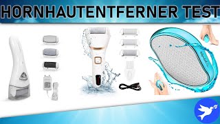 ᐅ Hornhautentferner Test 2023  Die besten Hornhautentferner vorgestellt [upl. by Esined715]