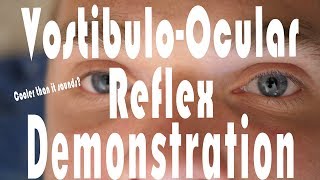 Caloric Testing COWS VestibuloOcular Reflex Hack  It Works [upl. by Mur]