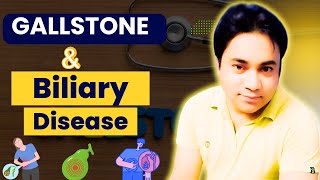 Gallstone and Biliary Disease  Clinical Anatomy [upl. by Eignat726]