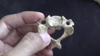 CERVICAL VERTEBRAE  QUICK IDENTIFICATION POINTS [upl. by Ylellan]