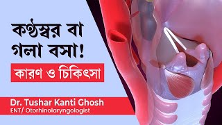 কন্ঠস্বর বা গলা বসে যাওয়ার কারণ ও চিকিৎসা  Hoarseness of voice Causes amp treatment in Bengali [upl. by Eveneg]