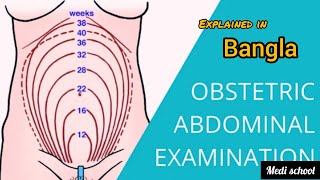 Pregnancy abdominal examination for obstetrics long case  final prof [upl. by Barrie]