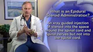 Epidural Steroid InjectionPatient Education Video [upl. by Corrine]