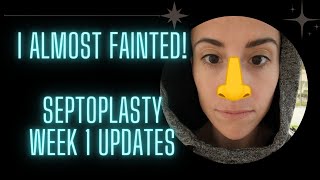 Septoplasty and Turbinate Reduction Recovery Timeline Before and After [upl. by Stead103]