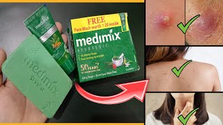 Medimix Ayurvedic Soap Review  Soap for all Skin Problems [upl. by Maite]