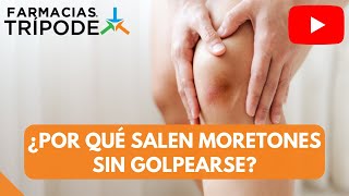 ¿Por qué salen moretones sin golpearse [upl. by Pancho]