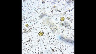 Blastocystis hominis [upl. by Aronal]