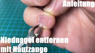 Niednagel Neidnagel entfernen mit Hautzange  Nagelpflege Anleitung [upl. by Ilysa]