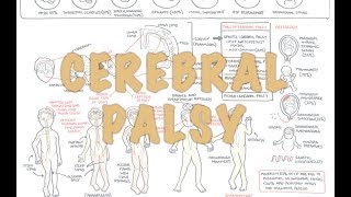 exercises for cerebral palsy strengthening exercises  spasticity management [upl. by Inalel]