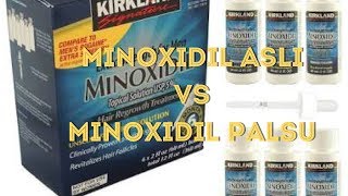 MINOXIDIL ASLI VS MINOXIDIL PALSU [upl. by Arinaid]