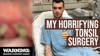 Tonsillectomy Surgery GONE WRONG  My Terrifying Experience and Recovery [upl. by Wilmar]