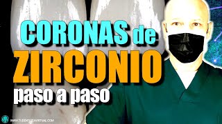 TRATAMIENTO PASO a PASO con CORONAS DE ZIRCONIO para NO tener problemas en el futuro del tratamiento [upl. by Irakuy]